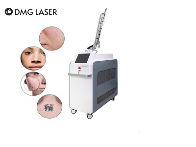 pico laser treatment 